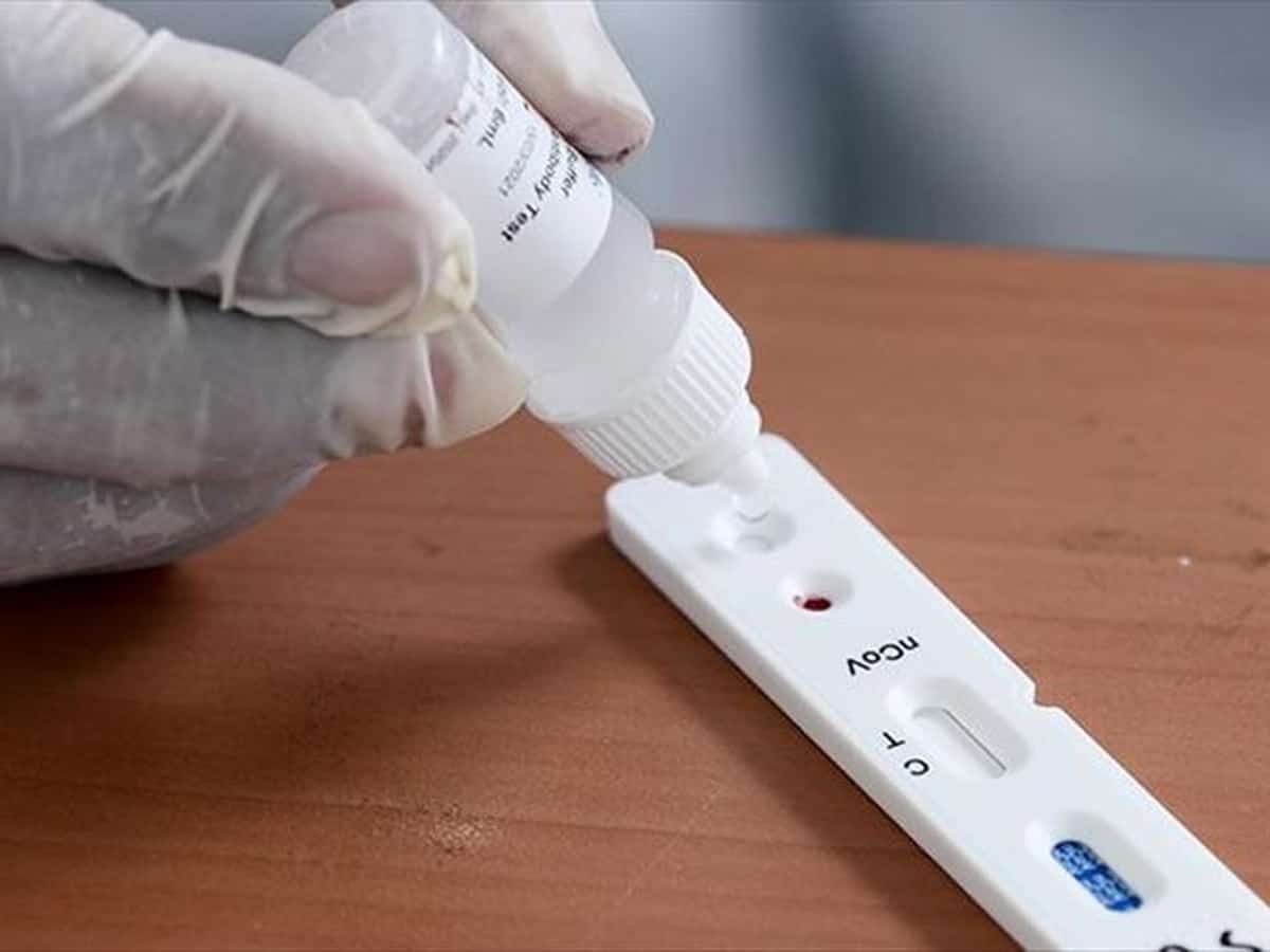 hiv test